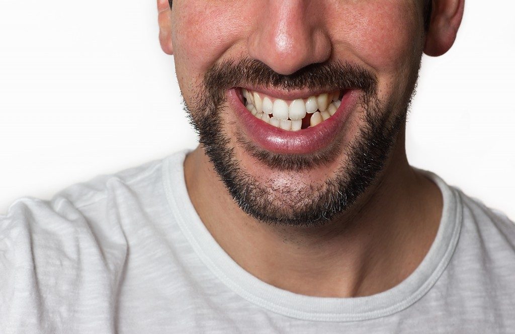 Smiling man with missing tooth